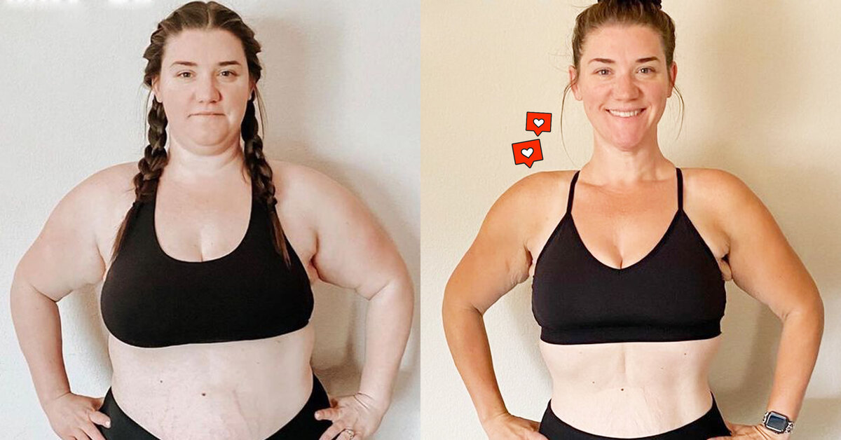 Как похудеть на дефиците калорий – история похудения на 40 кг с фото
