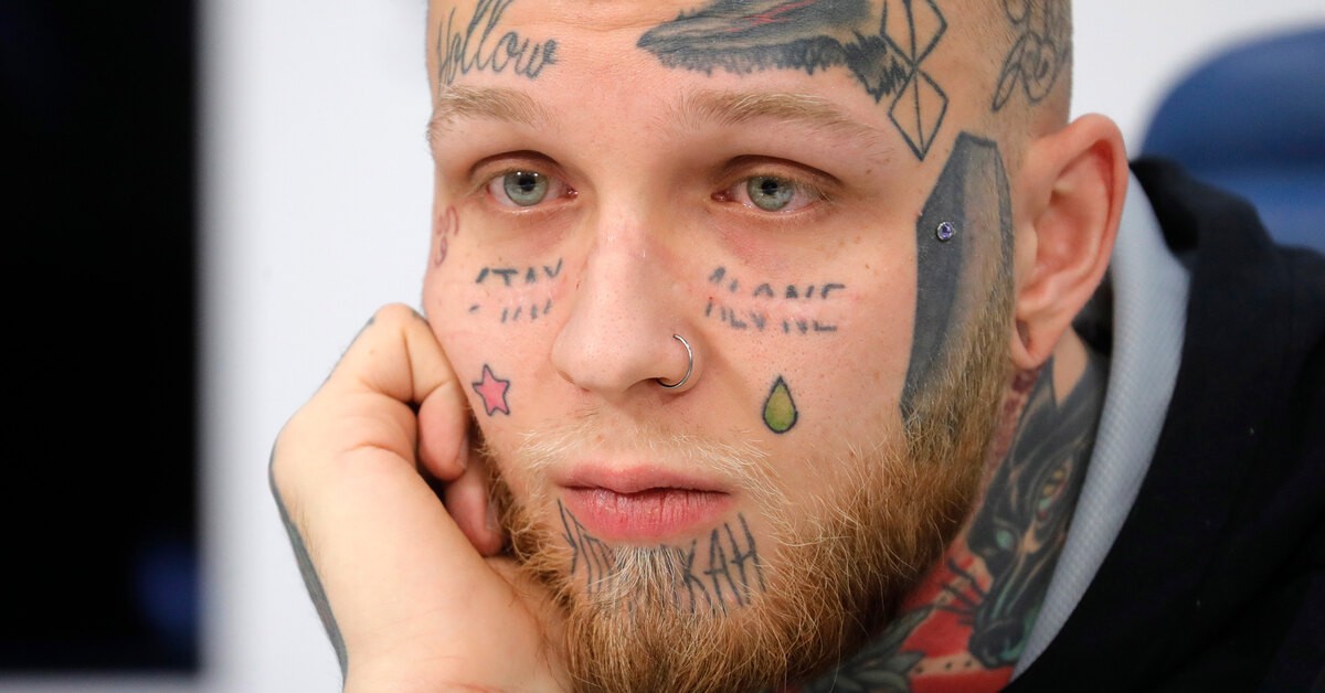 Как выглядит лицо, с которого удалили татуировку