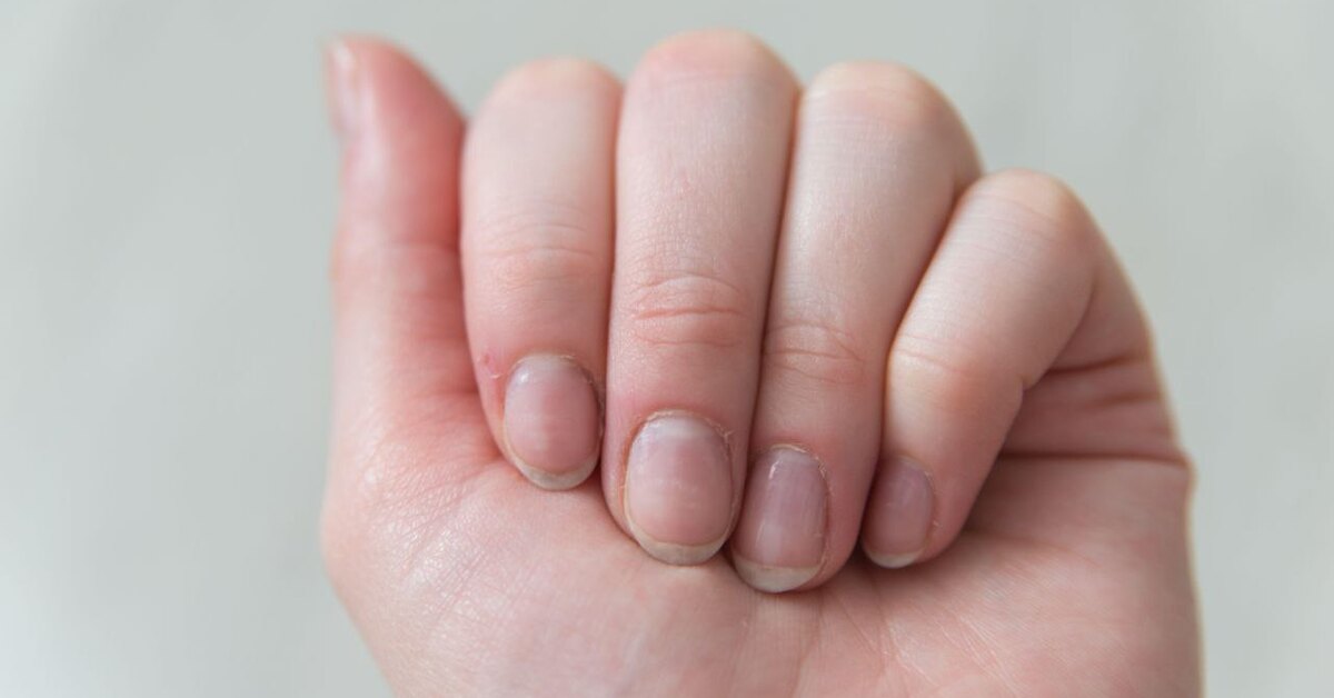 Нейл-криптонит: какая ежедневная процедура делает ногти хрупкими и ломкими