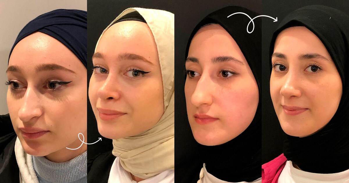 Как пластика носа может изменить лицо: 5 впечатляющих преображений турчанок