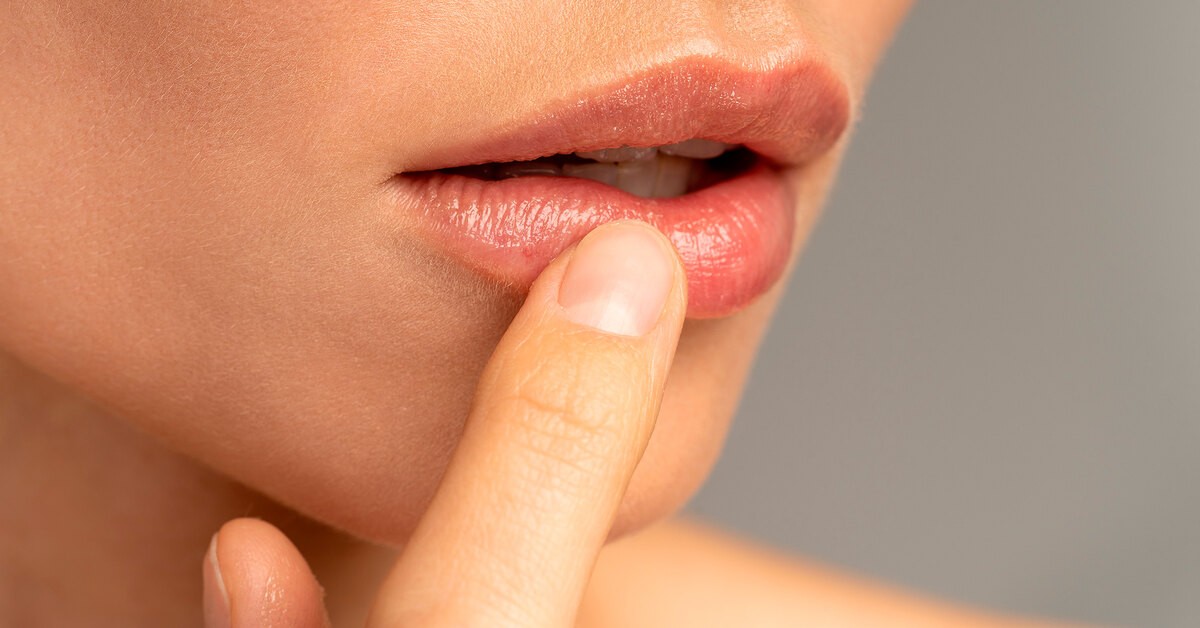 Болезнь Фордайса: как избавиться от гранул на губах